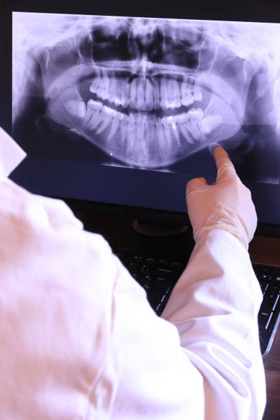 Best Emergency Tooth Extraction in Spring Valley Lake, CA